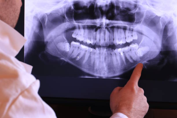Best Broken or Cracked Tooth Emergency Dentist in Corte Madera, CA