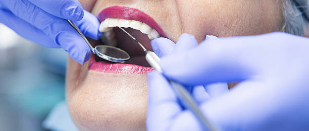 Best Pediatric Emergency Dentist in Corte Madera, CA
